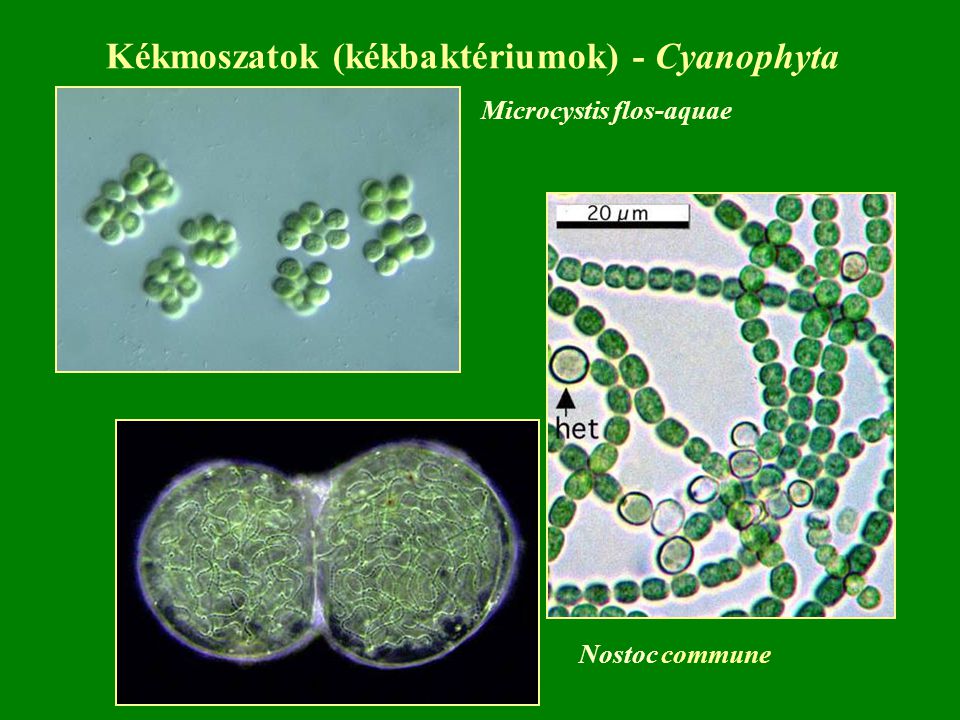 Kékmoszatok (kékbaktériumok) - Cyanophyta Microcystis flos-aquae