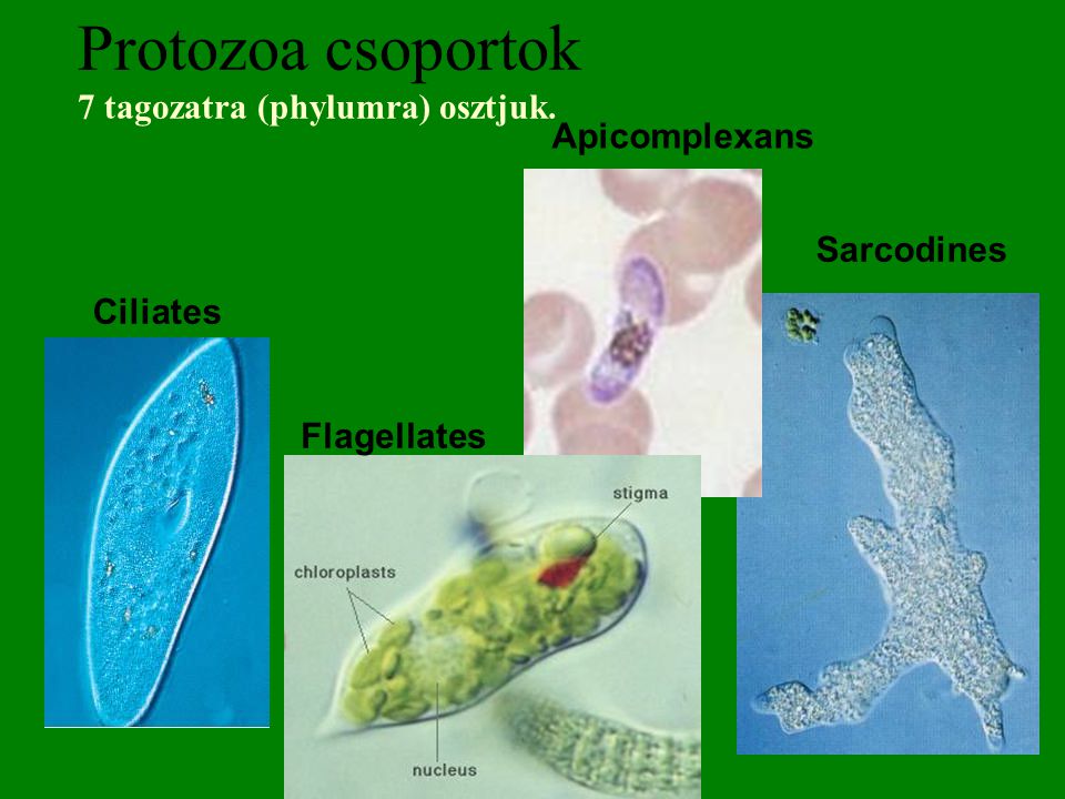 Protozoa csoportok 7 tagozatra (phylumra) osztjuk.