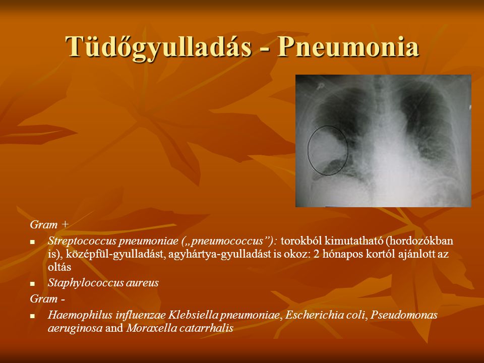 Tüdőgyulladás - Pneumonia
