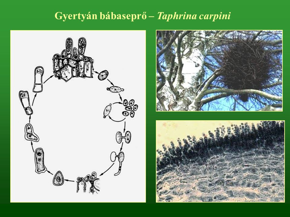 Gyertyán bábaseprő – Taphrina carpini