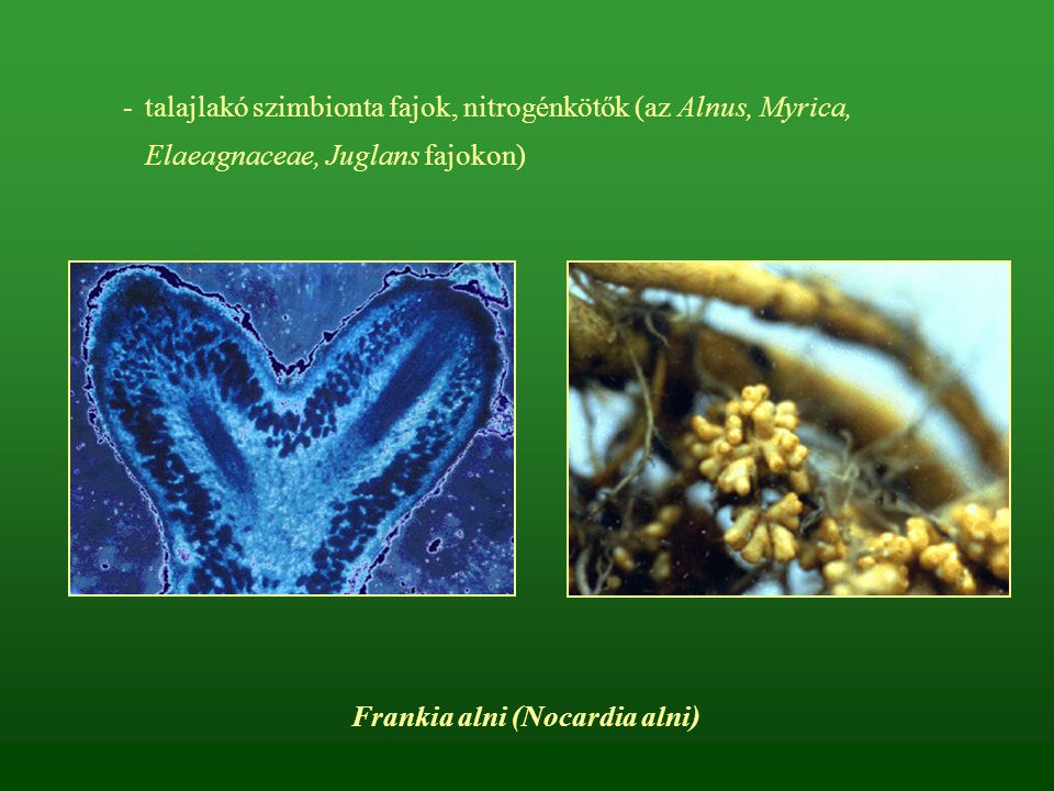 Frankia alni (Nocardia alni)
