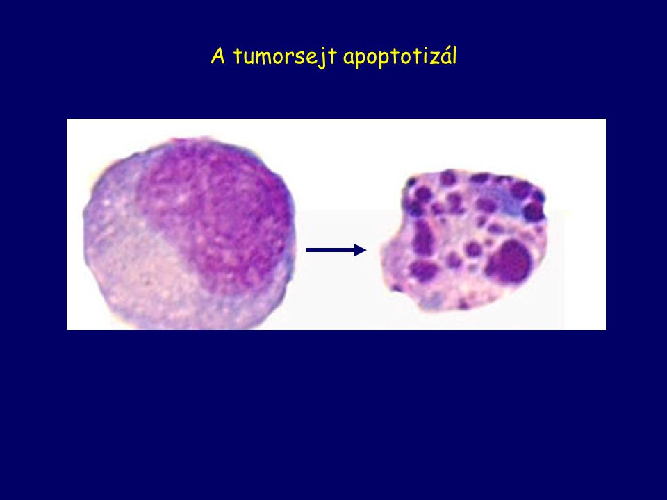 A tumorsejt apoptotizál