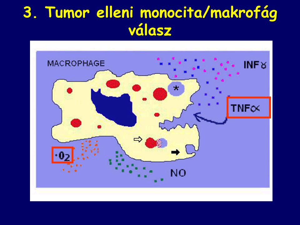 3. Tumor elleni monocita/makrofág válasz