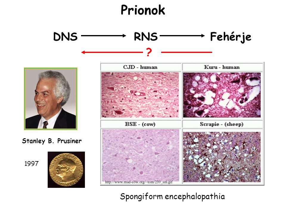 Prionok DNS RNS Fehérje Spongiform encephalopathia
