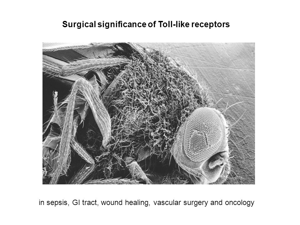 Surgical significance of Toll-like receptors