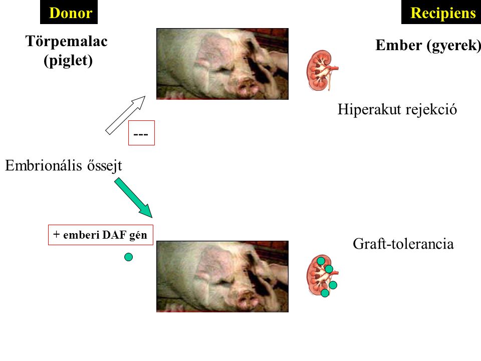 Donor Recipiens Törpemalac (piglet) Ember (gyerek) Hiperakut rejekció