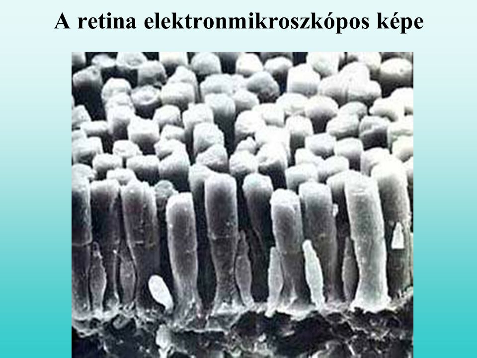 A retina elektronmikroszkópos képe