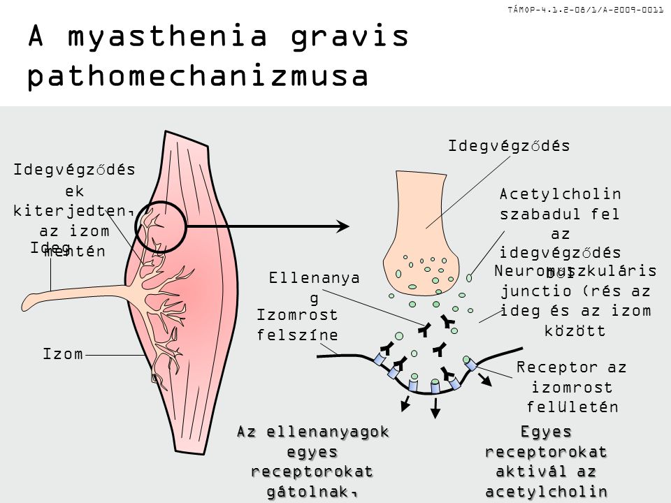A myasthenia gravis pathomechanizmusa