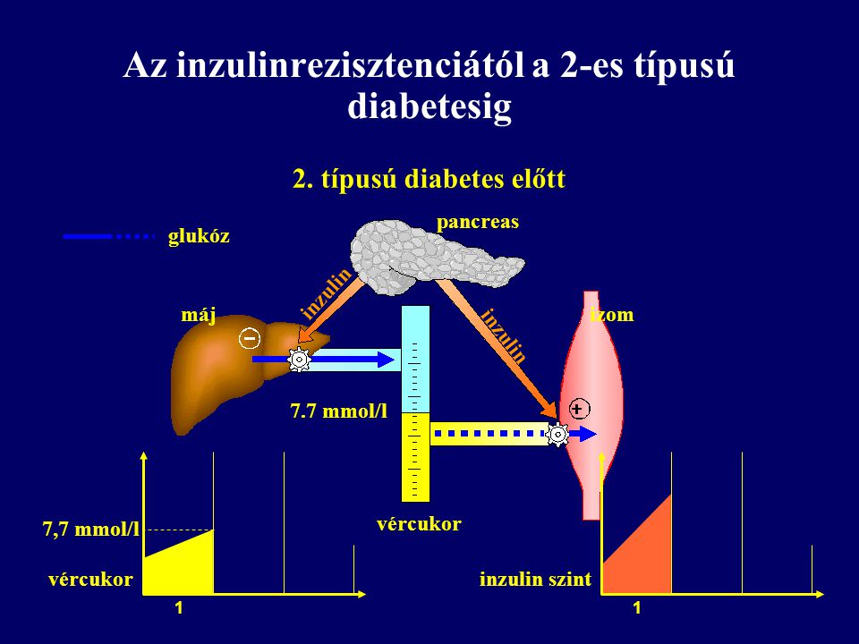 Az inzulinrezisztenciától a 2-es típusú diabetesig