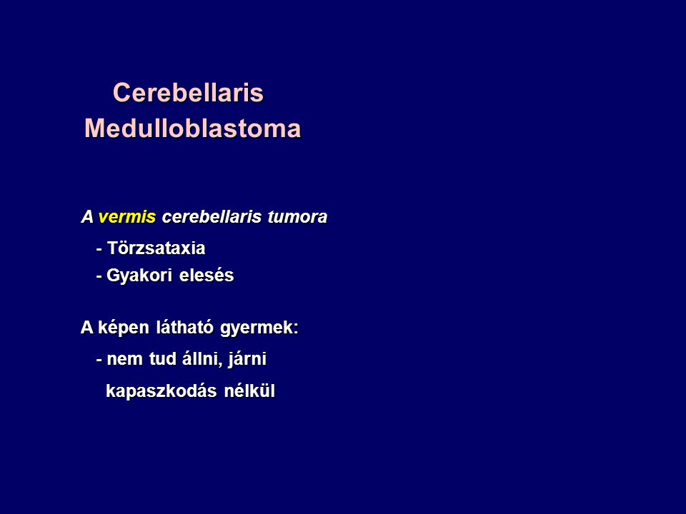 Cerebellaris Medulloblastoma
