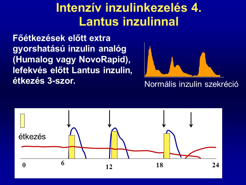 Intenzív inzulinkezelés 4. Lantus inzulinnal