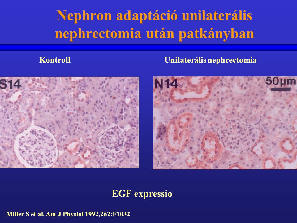 Nephron adaptáció unilaterális nephrectomia után patkányban