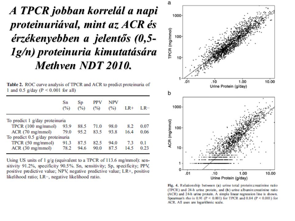 A TPCR jobban korrelál a napi proteinuriával, mint az ACR és érzékenyebben a jelentős (0,5-1g/n) proteinuria kimutatására Methven NDT 2010.