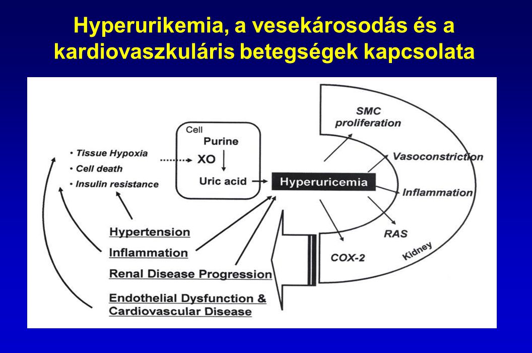 Hyperurikemia, a vesekárosodás és a kardiovaszkuláris betegségek kapcsolata