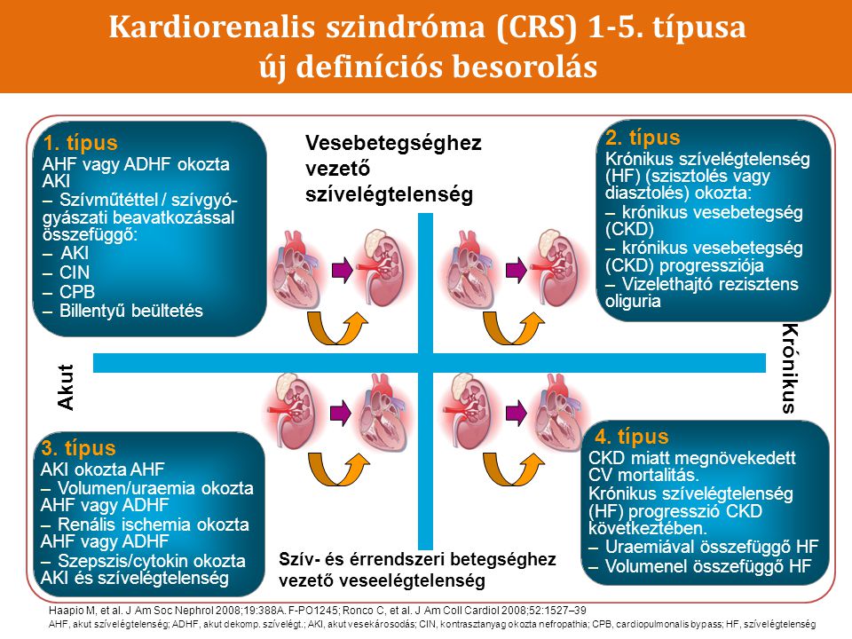 Kardiorenalis szindróma (CRS) 1-5. típusa új definíciós besorolás