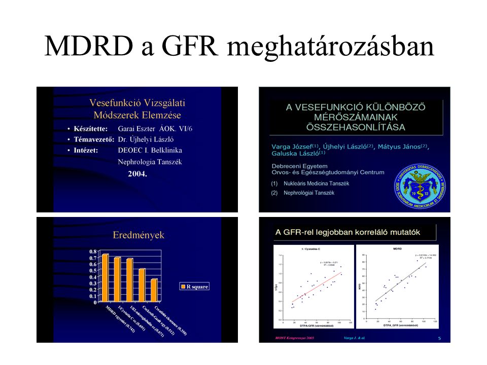 MDRD a GFR meghatározásban