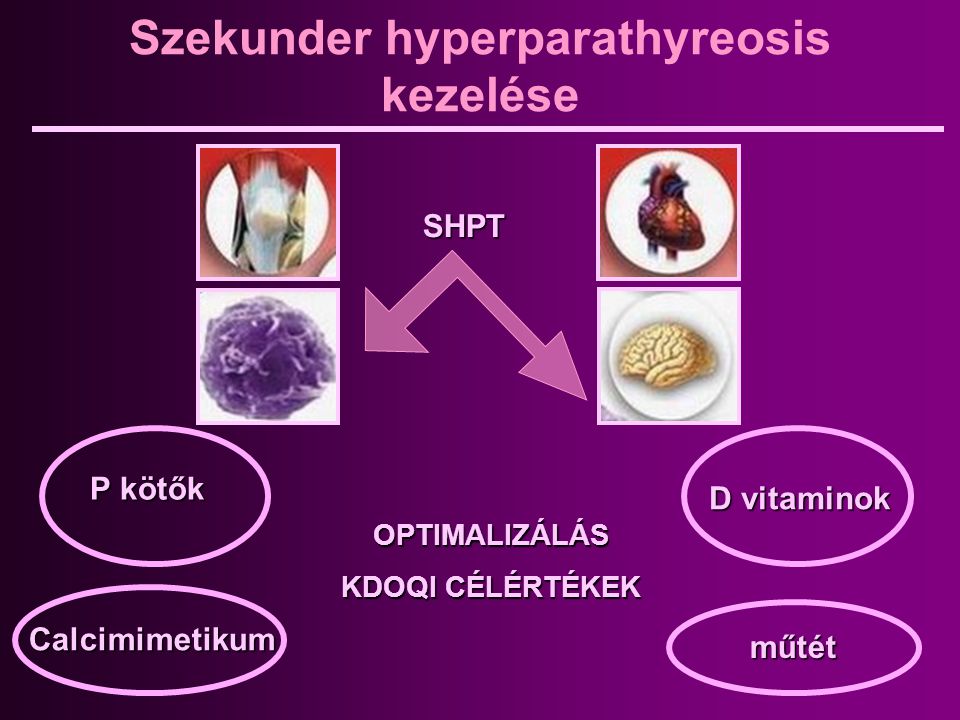 Szekunder hyperparathyreosis kezelése