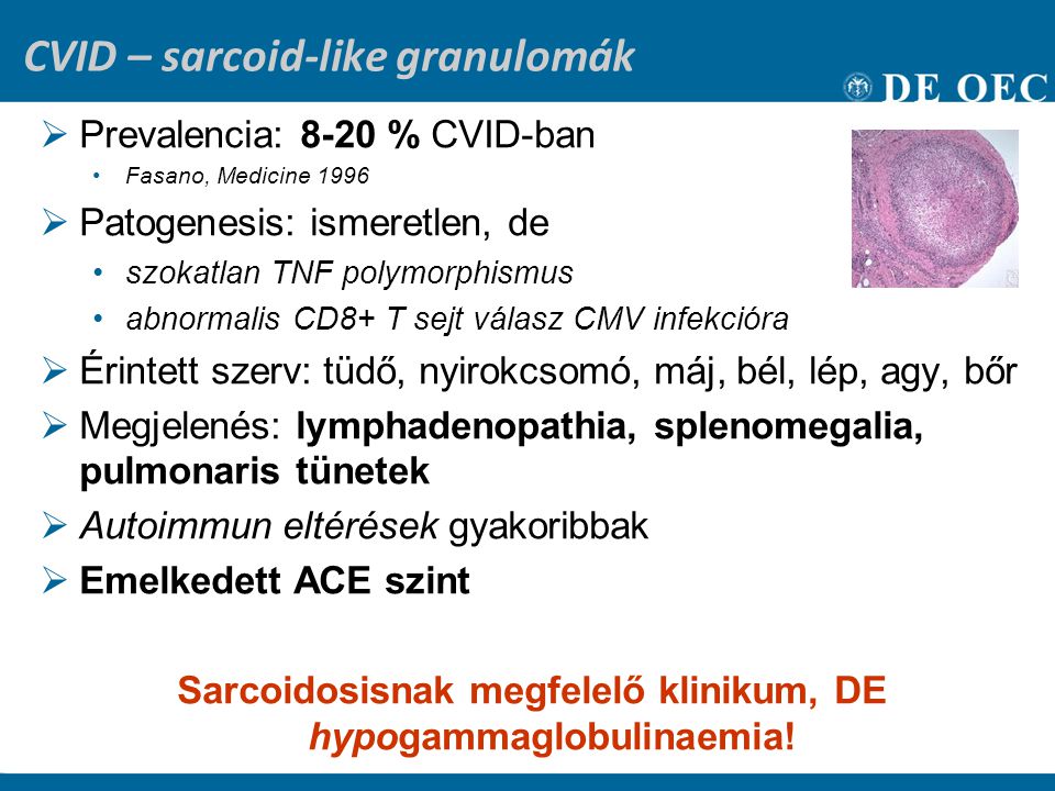 CVID – sarcoid-like granulomák
