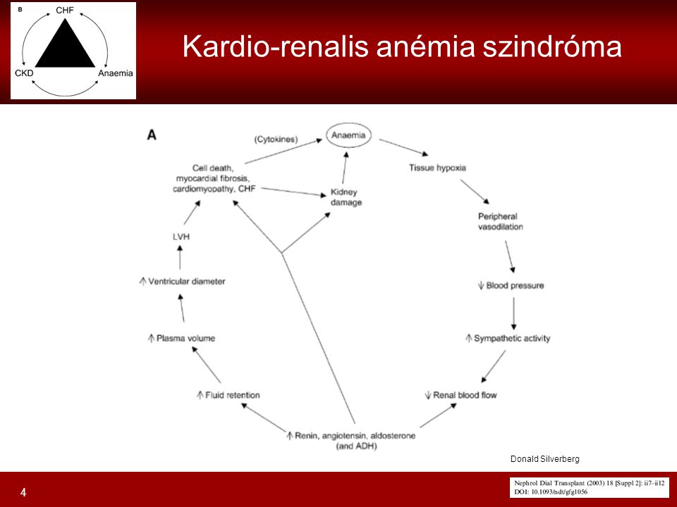 Kardio-renalis anémia szindróma