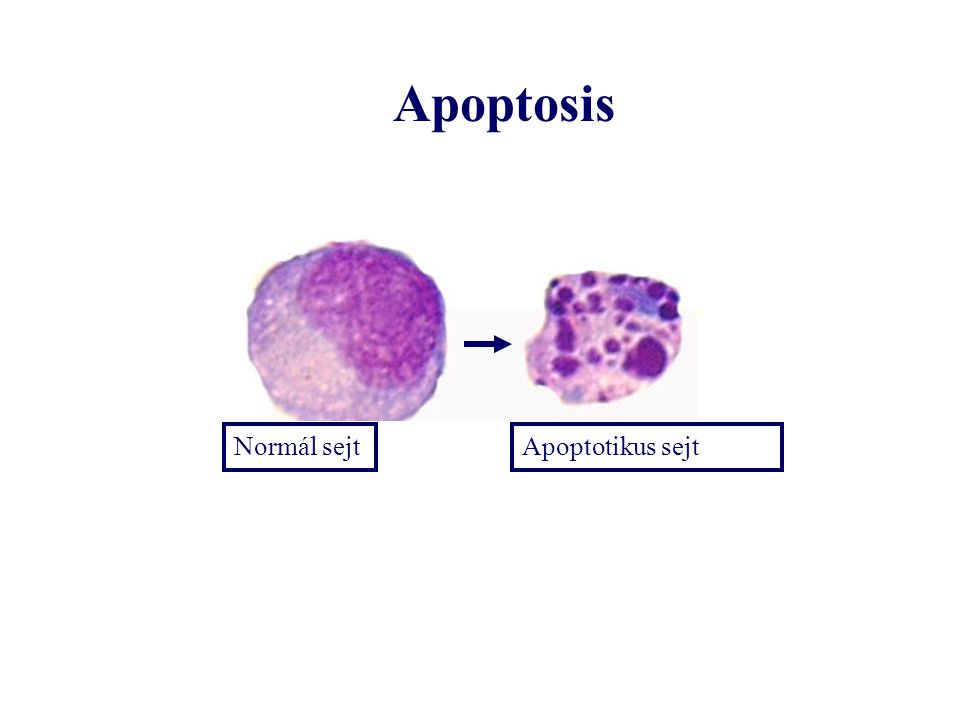 Apoptosis Normál sejt Apoptotikus sejt