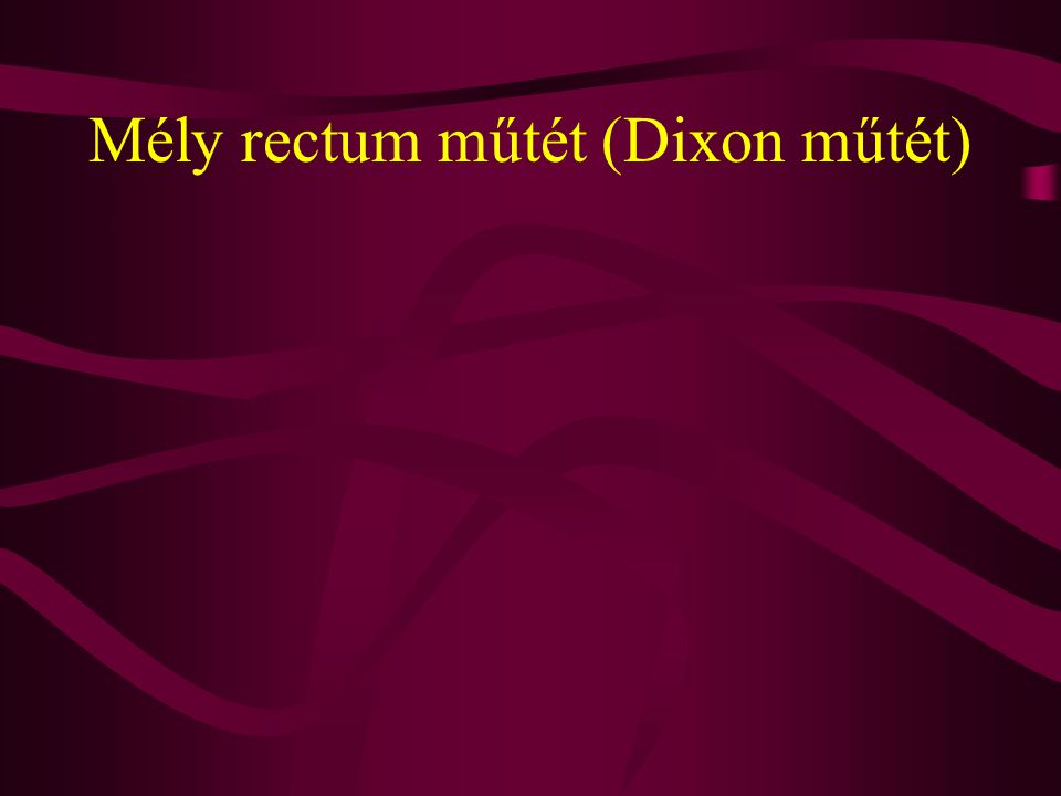 Mély rectum műtét (Dixon műtét)