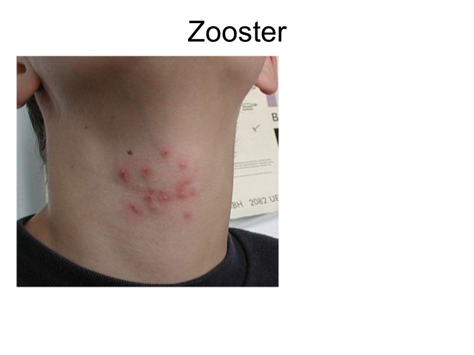 Zooster
