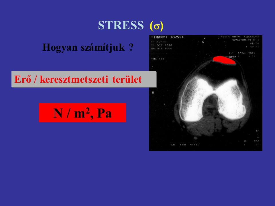 STRESS () Hogyan számítjuk Erő / keresztmetszeti terület N / m2, Pa
