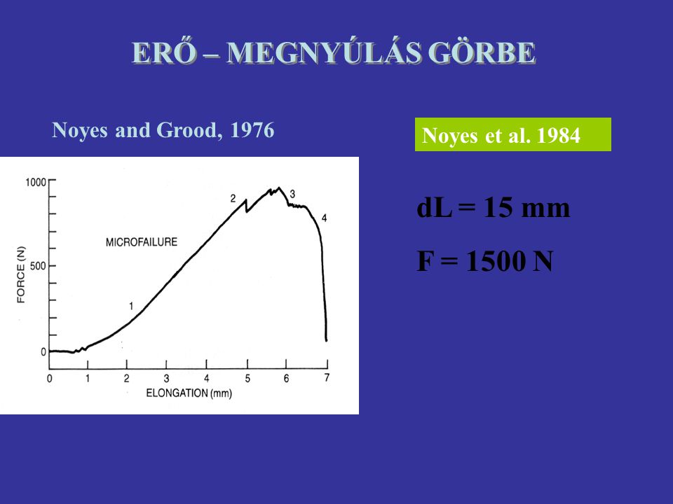 ERŐ – MEGNYÚLÁS GÖRBE dL = 15 mm F = 1500 N Noyes and Grood, 1976