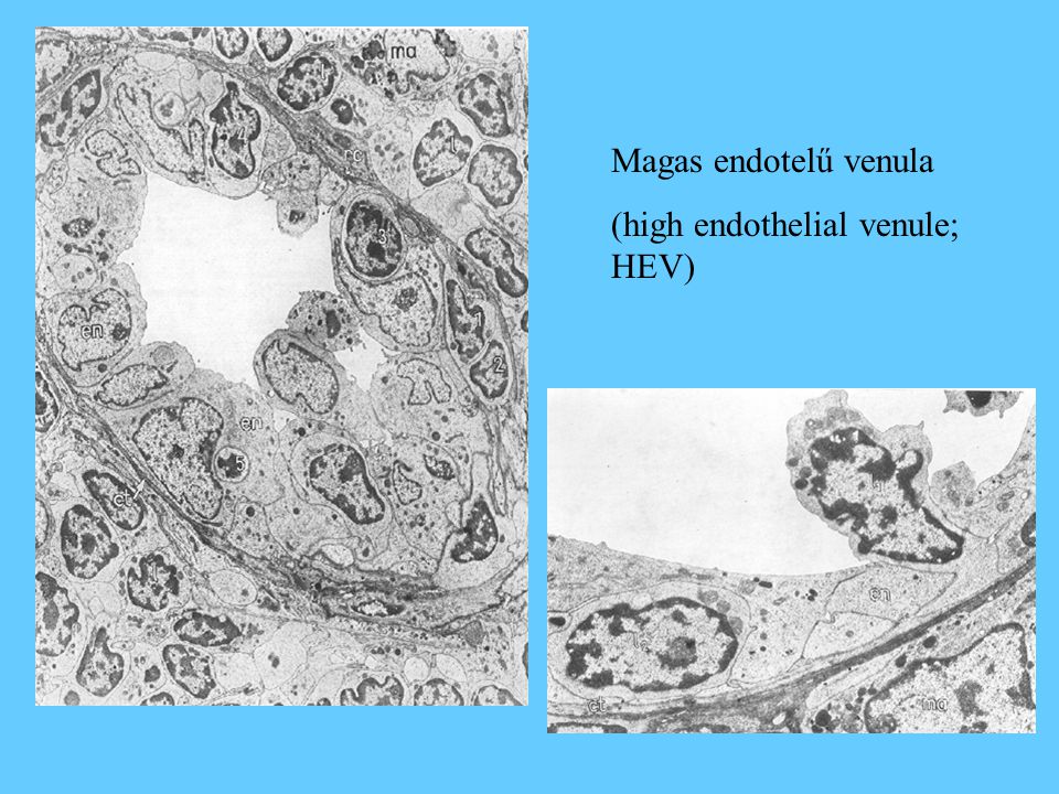 Magas endotelű venula (high endothelial venule; HEV)