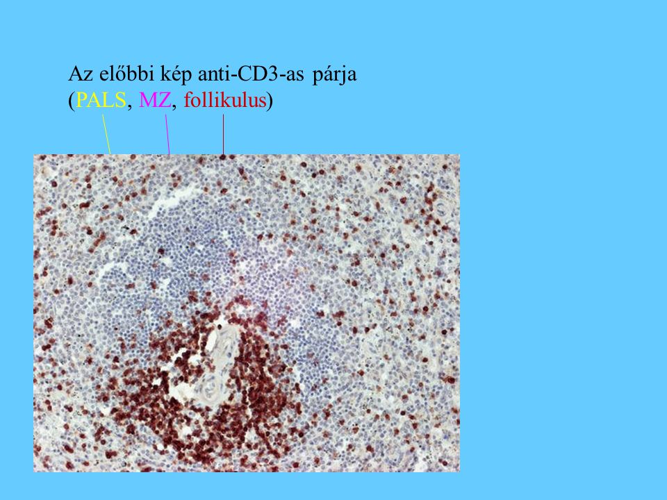 Az előbbi kép anti-CD3-as párja (PALS, MZ, follikulus)