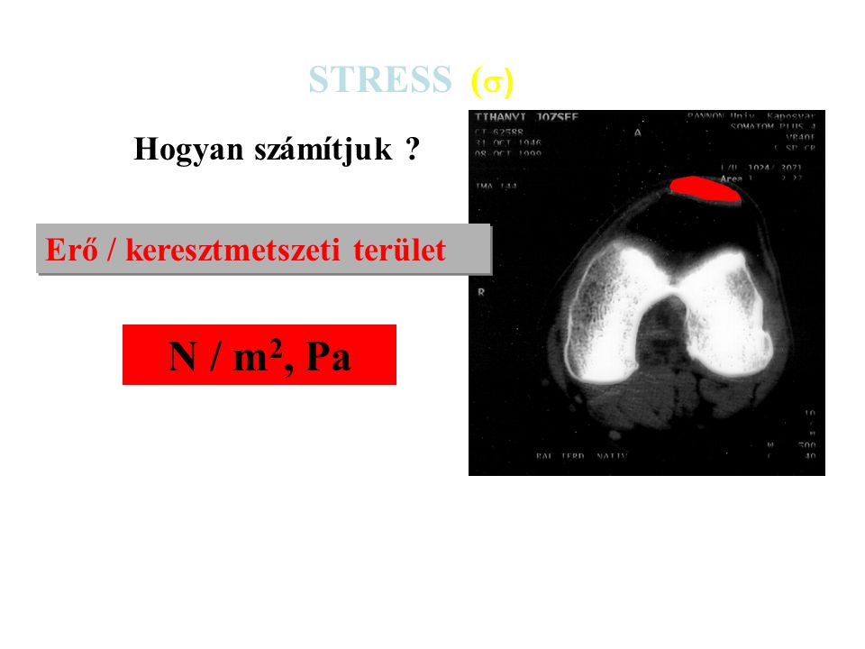 STRESS () Hogyan számítjuk Erő / keresztmetszeti terület N / m2, Pa