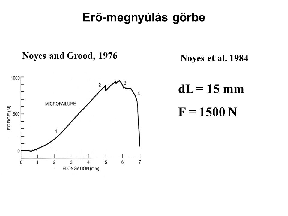 dL = 15 mm F = 1500 N Erő-megnyúlás görbe Noyes and Grood, 1976