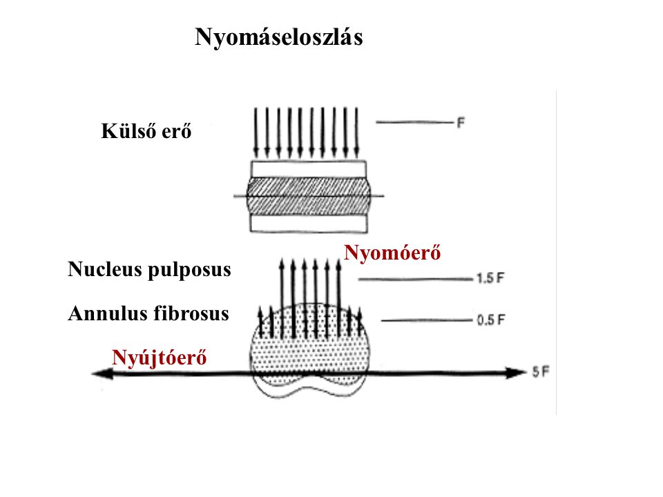 Nyomáseloszlás Külső erő Nyomóerő Nucleus pulposus Annulus fibrosus