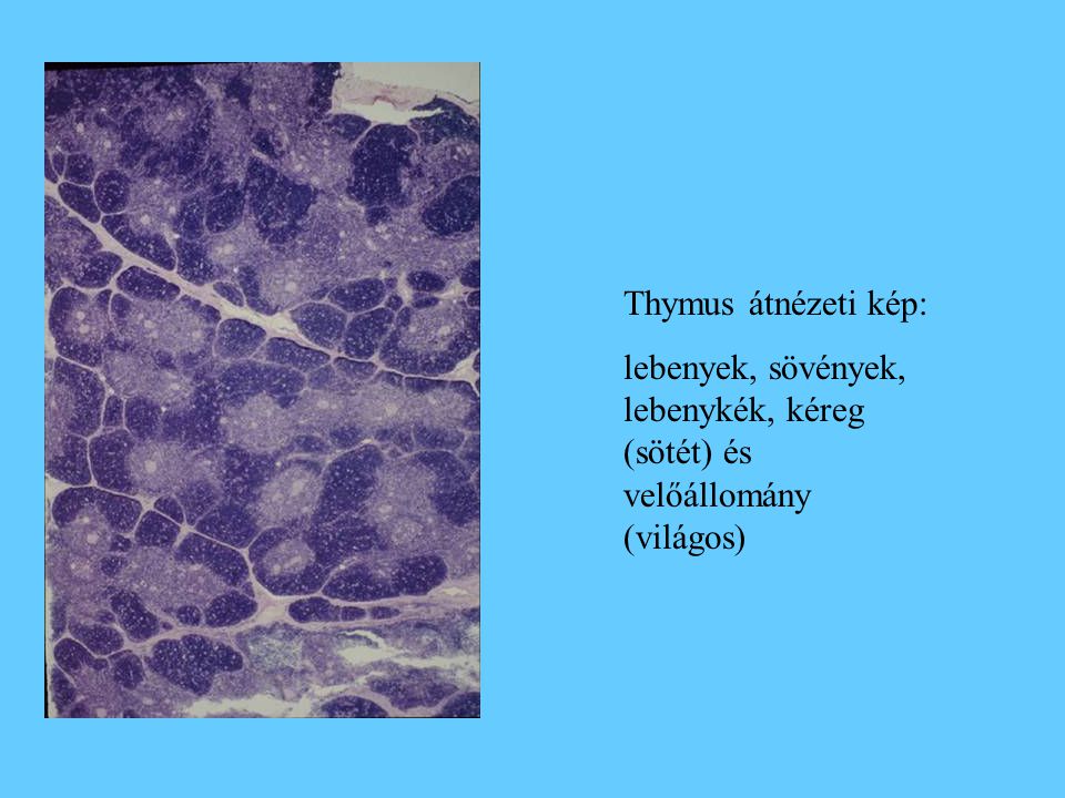 Thymus átnézeti kép: lebenyek, sövények, lebenykék, kéreg (sötét) és velőállomány (világos)