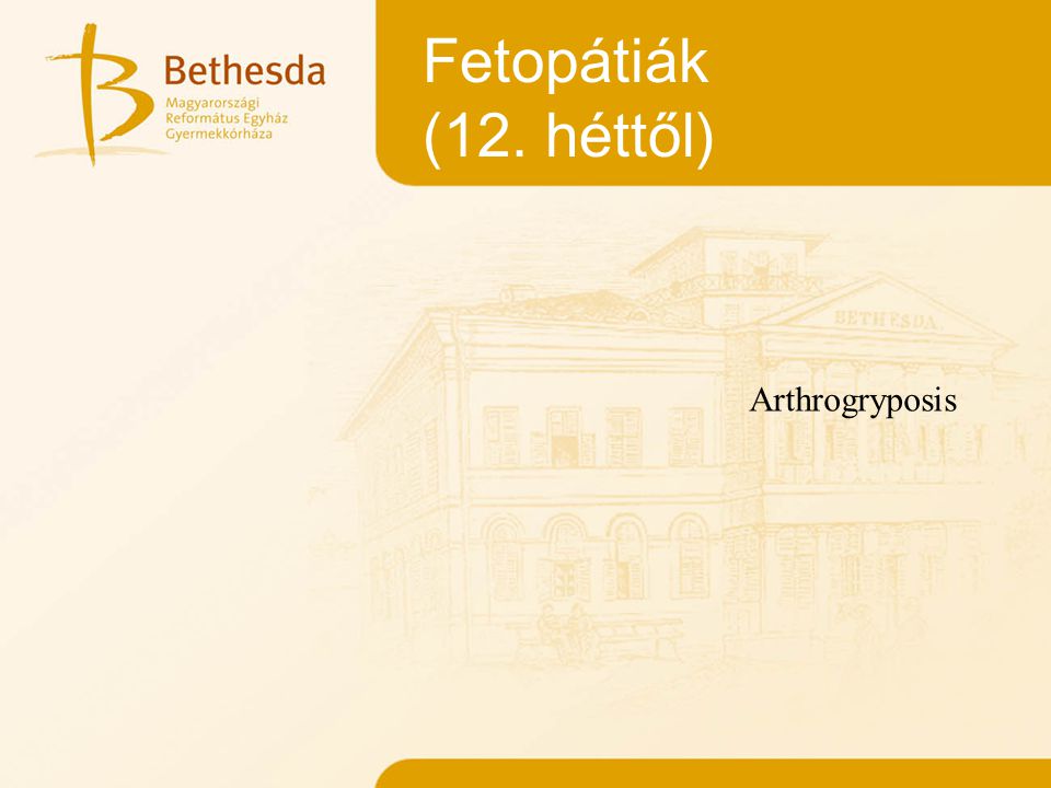 Fetopátiák (12. héttől) Arthrogryposis