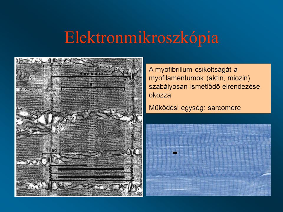 Elektronmikroszkópia