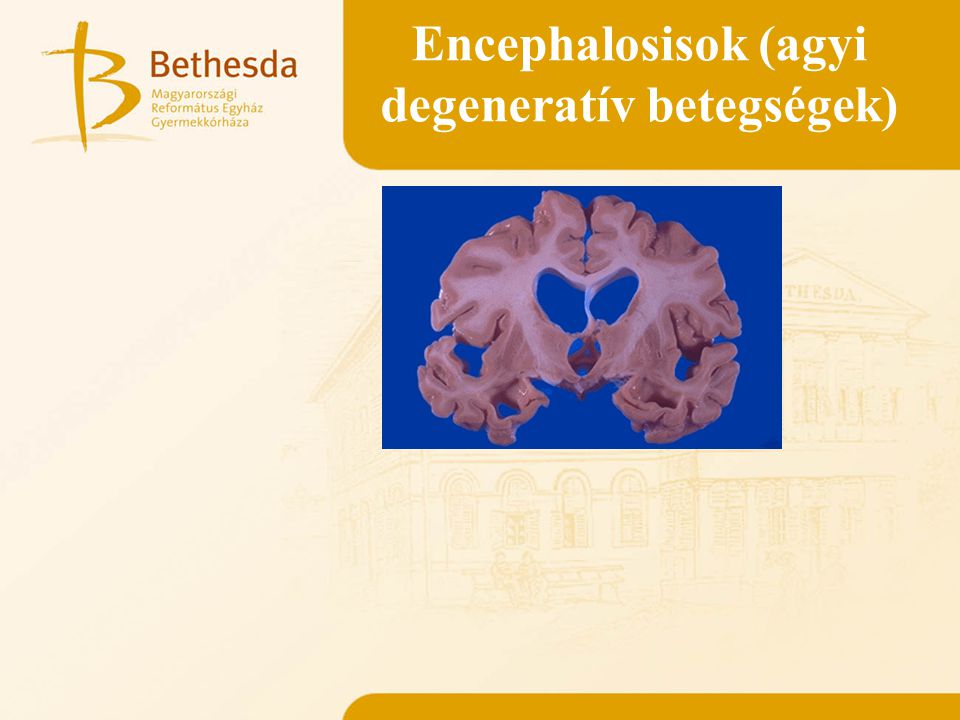 Encephalosisok (agyi degeneratív betegségek)