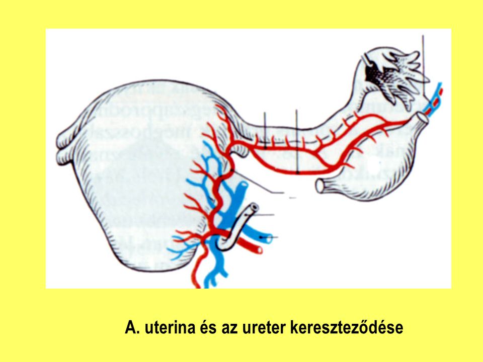 A. uterina és az ureter kereszteződése