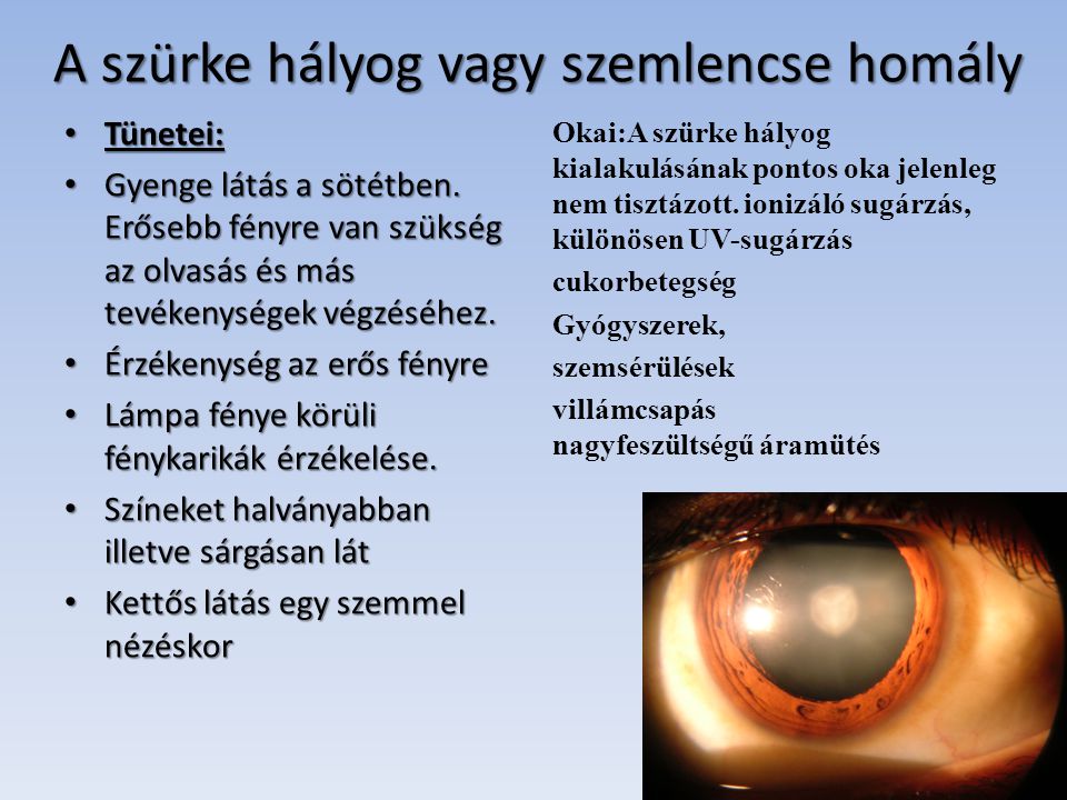 látási betegségek)