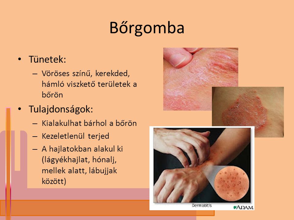 bőrbetegségek ppt)