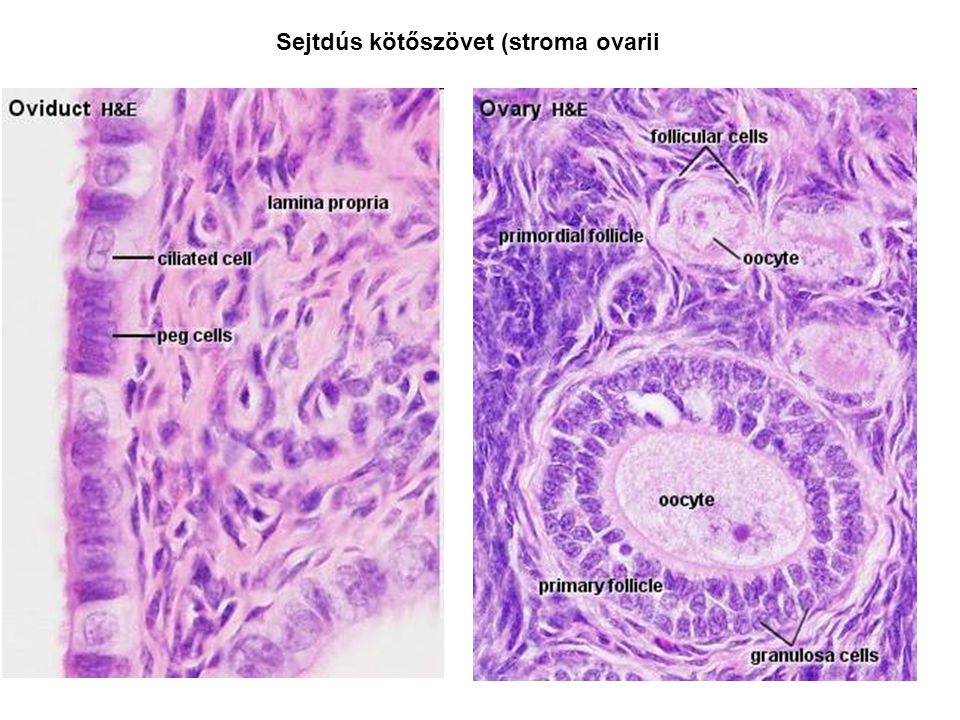 Sejtdús kötőszövet (stroma ovarii