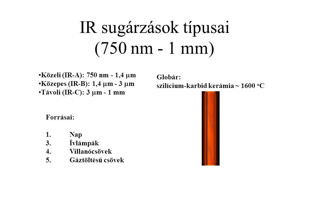 IR sugárzások típusai (750 nm - 1 mm)