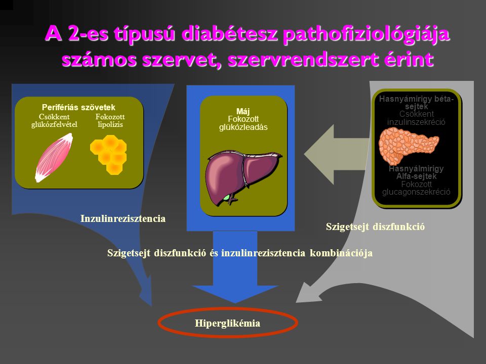 Diéta a 2. típusú diabétesz esetében a 9. táblázatban