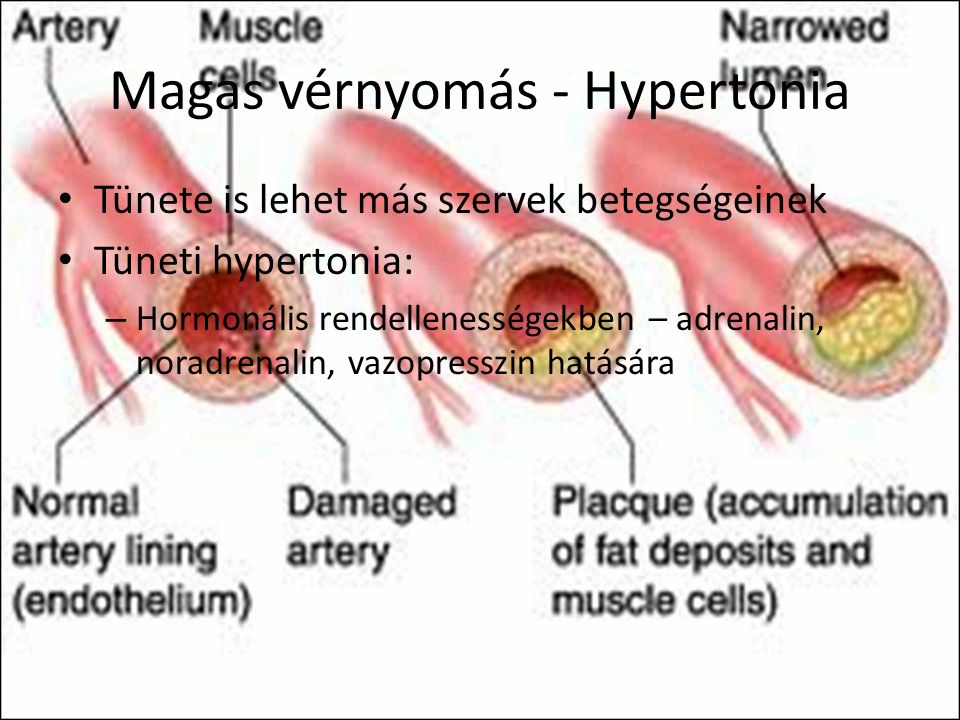 vazopresszin hipertónia