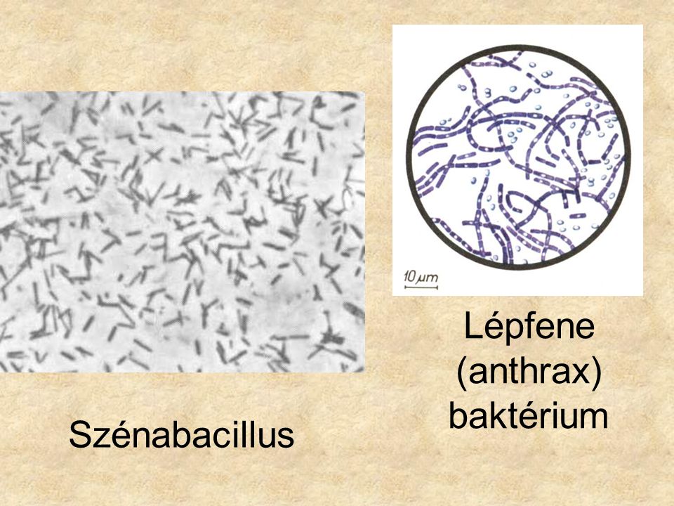 Lépfene (anthrax) baktérium