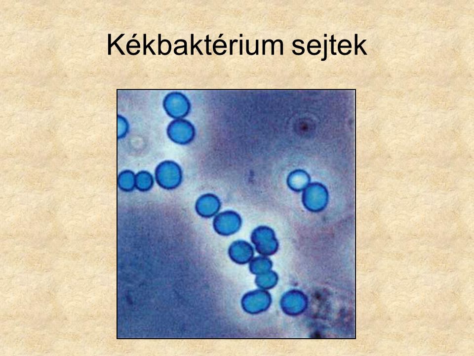 Kékbaktérium sejtek Lovas: Édesvízi parányok 1. (növények) Búvár zsebkönyvek, Móra Kiadó