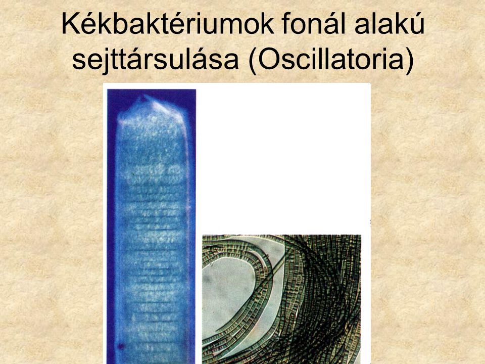 Kékbaktériumok fonál alakú sejttársulása (Oscillatoria)