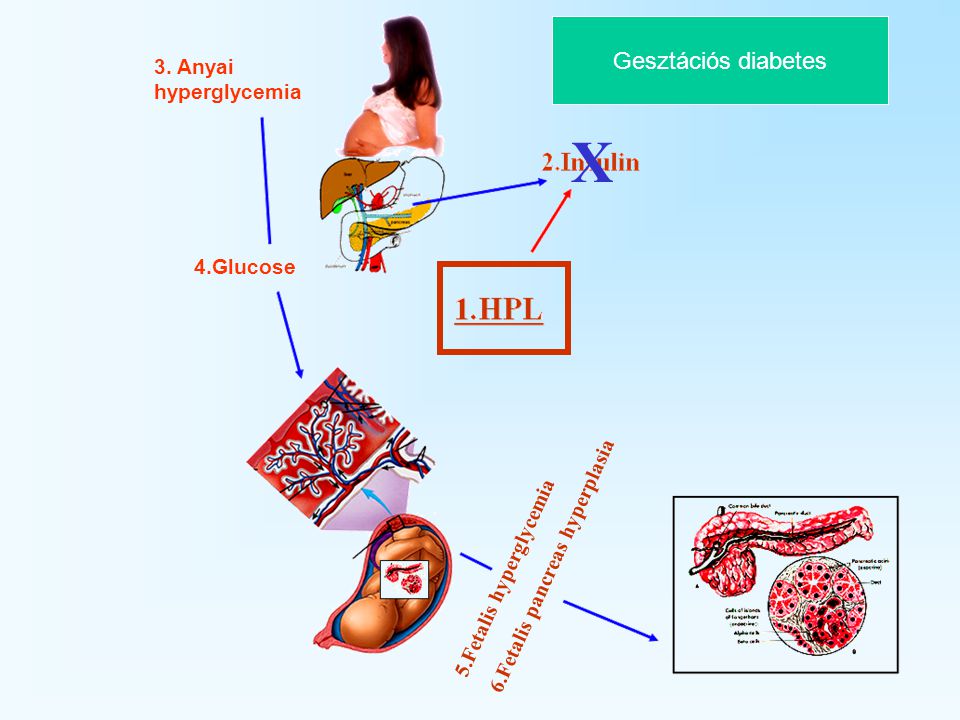 gesztacios diabetesz bee nucleus kezelés cukorbetegség