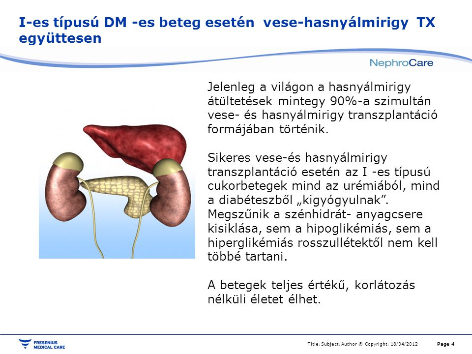 cukorbetegség kezelésére hasnyálmirigy transzplantáció)