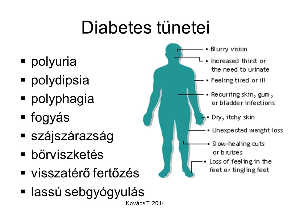 diabetes diagnosztikája és kezelése
